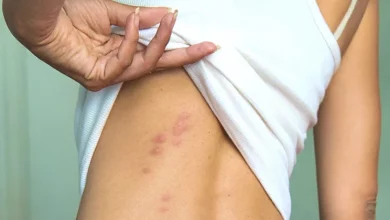 Opsnost Klopov 2.jpg