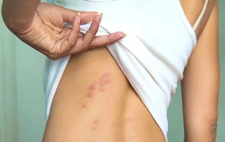 Opsnost Klopov 2.jpg