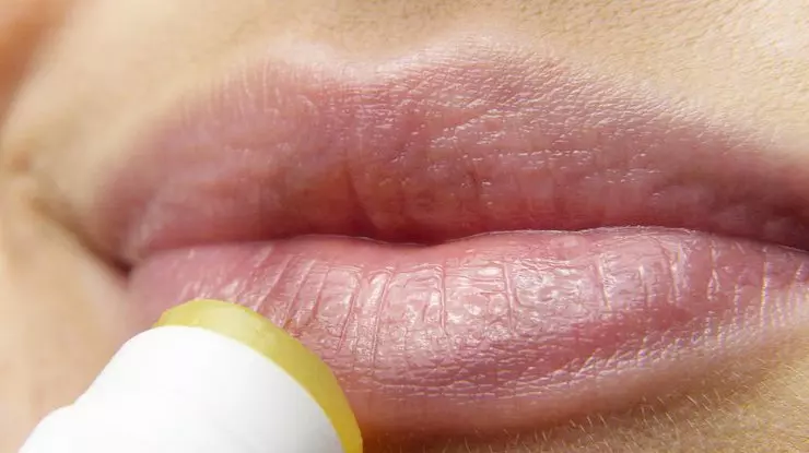 Foto Pixabay Rect 308b94b636c113bb5cf7df544d71dcc0