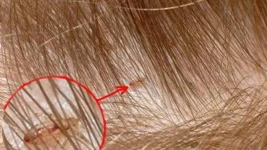 K Chemu Snyatsya Vshi 3