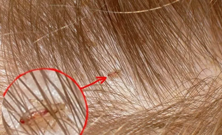 K Chemu Snyatsya Vshi 3