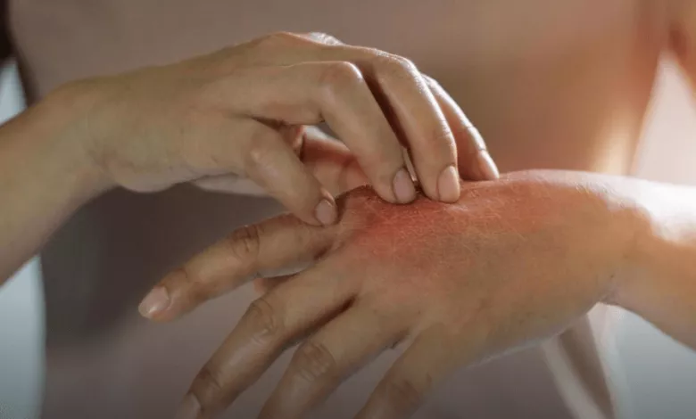 Thumb 960 400 0 0 Auto