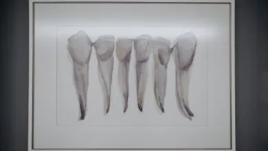 Artistic depiction of extracted teeth framed and displayed in a dental clinic.